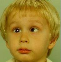 crosseyed2.JPG