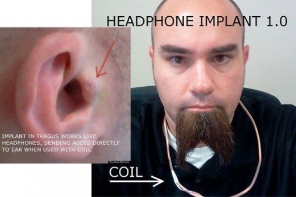 headphoneimplant.jpg